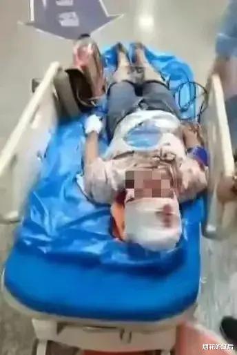 果然是江湖老手，唐山打人事件主犯陈继志因为头部被医院诊断为伤情中级