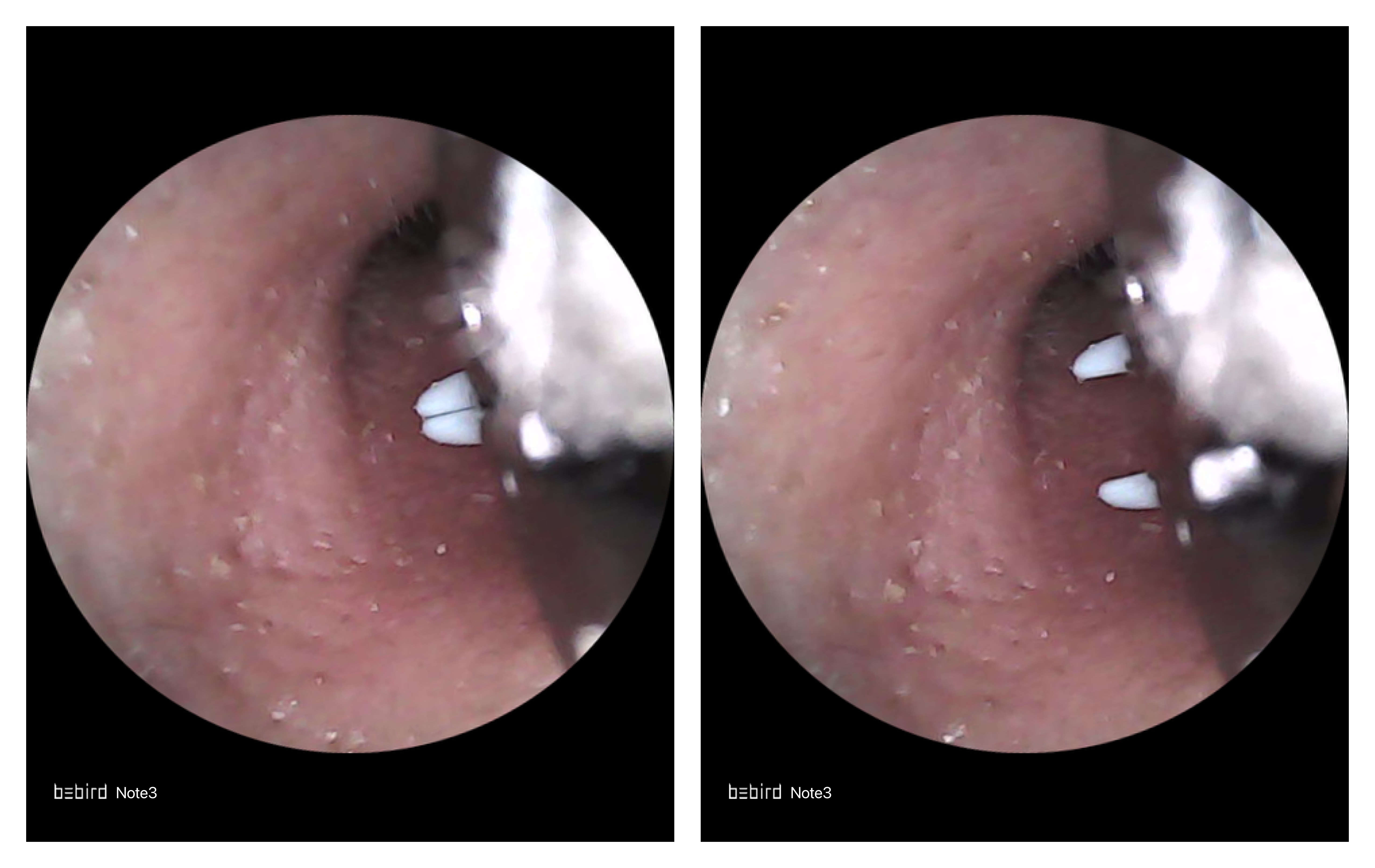 空调|看得见掏得着,bebird Note3 Pro Max三合一全能可视采耳仪