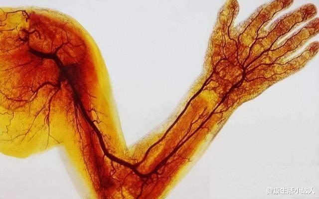 胆固醇|血管堵没堵,自己知道,多摸摸这4个地方,血管好坏早掌握