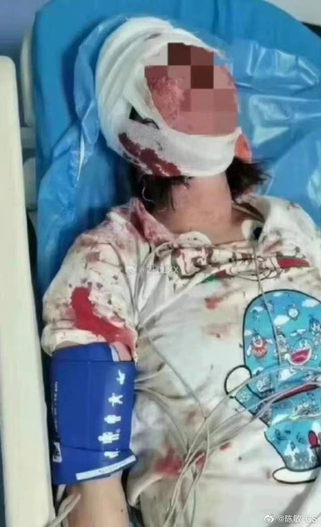 唐山打人男子还能直播叫嚣?“赔了六十万和解了!”问题在哪?