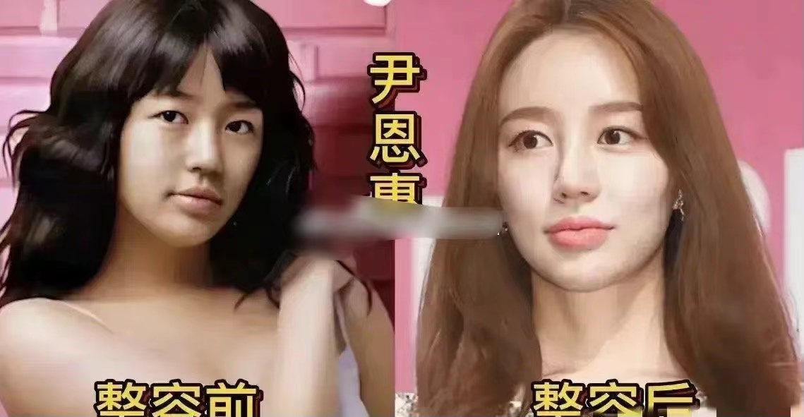 |原来这些韩国明星都整过容。