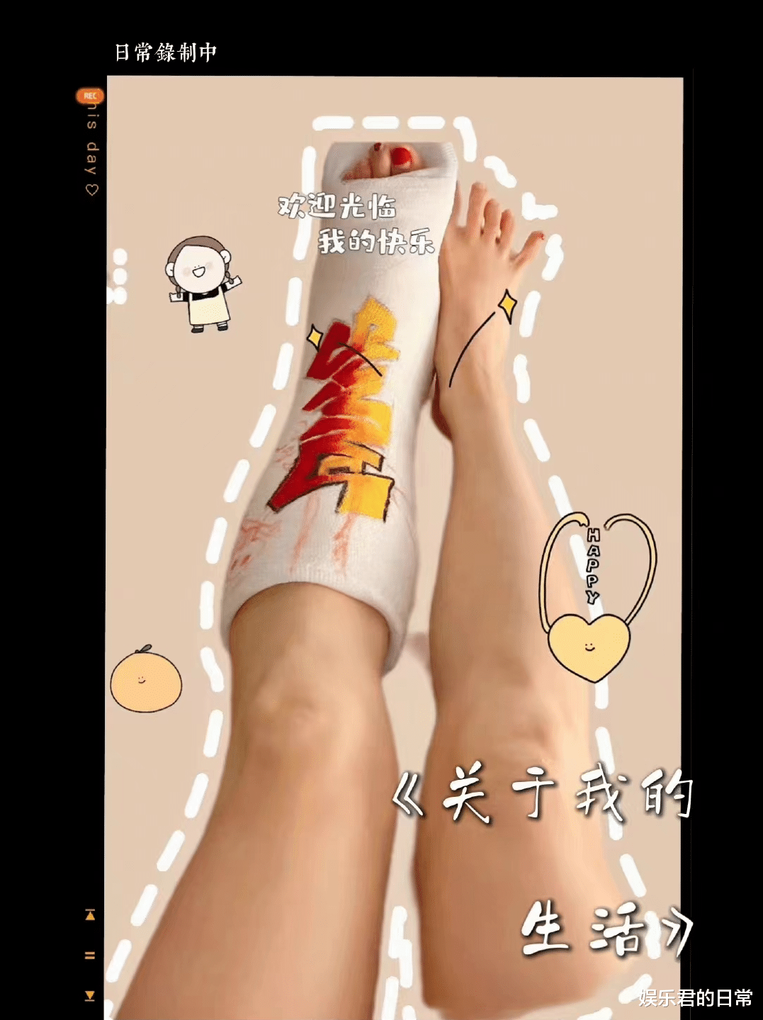 孙悦|49岁孙悦伤势变严重！宅家不能动浑身痛，晒与富豪老公之子显帅气