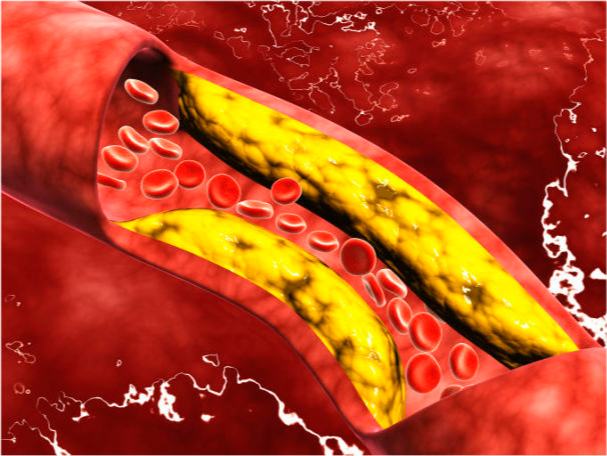 胆固醇|食物中的胆固醇“大户”公布，鸡蛋位列末尾，看完榜首，尽早忌口