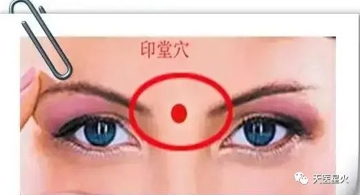 牛奶|古方 土方:放血法(五官科)