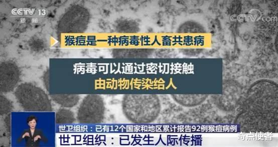 “猴痘”是DNA病毒，为何却疑似进化了？它会成为新型病毒大流行吗