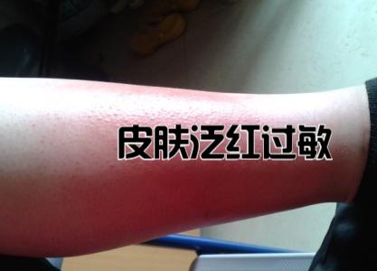 房子住了十几年还有甲醛?身上发生这几个情况,说明你中招了!