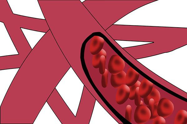 蜂蜜|过了45岁后,身上若出现三种怪现象,十有八九是血管堵了