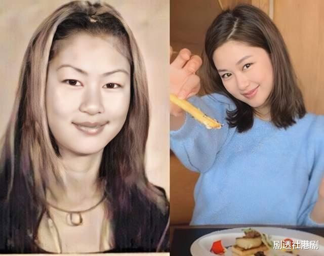 整容|香港知名女星再陷整容疑云!嘴唇像打了丰唇针,网友:老了20岁