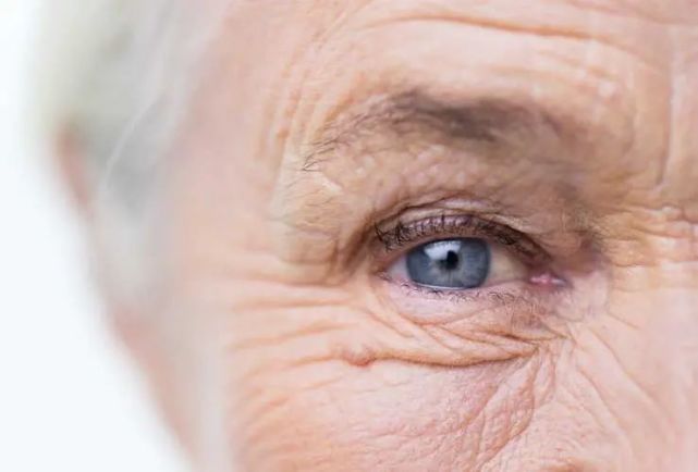 吕晓冉：老年性双眼皮手术的常见问题探讨丨专业视点