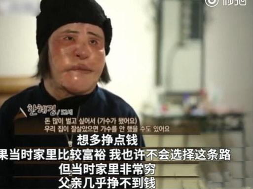 韩慧景|“镜子公主整容记”:面部注射大豆油和润滑油,丑到把自己吓哭