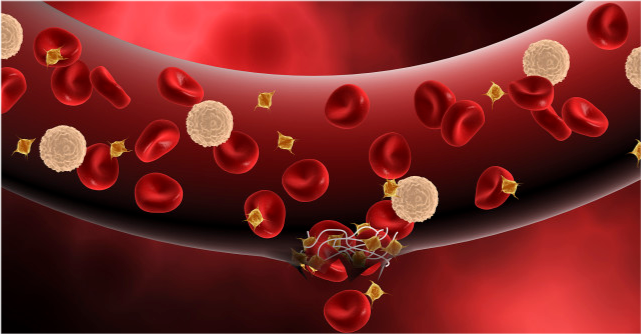 高血压|早晨是降血脂的黄金时间,吃对5种早餐,有利于稳定血脂不超标