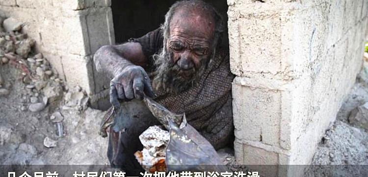 年轻时感情受挫惩罚自己,男子60多年不洗澡,第一次洗澡后就死了