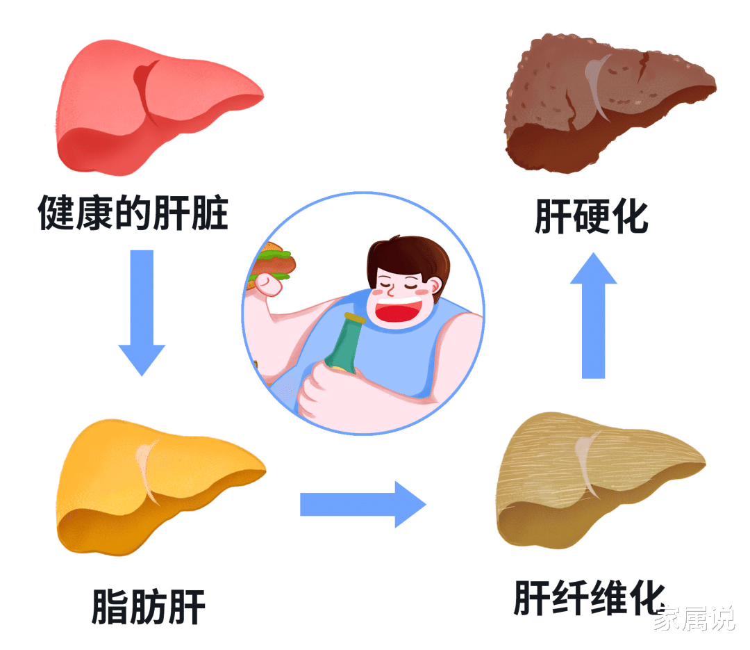 鸡胸肉 患有脂肪肝时该吃什么？这9种食物必不可少！