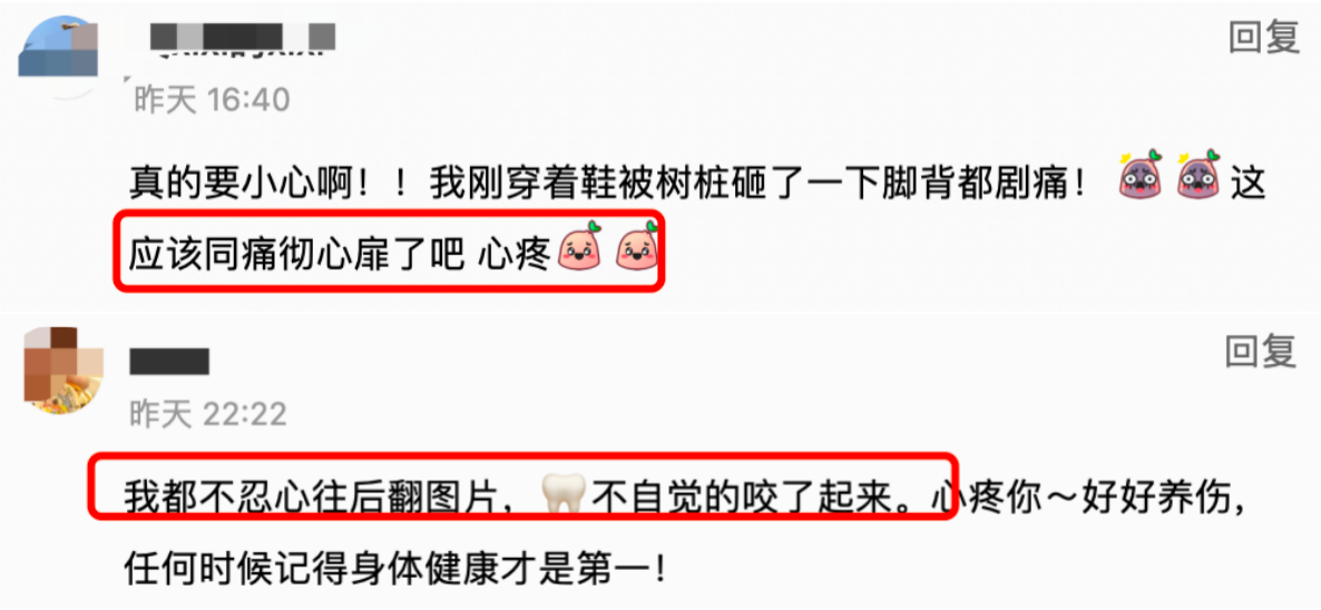 佟晨洁|超模佟晨洁大脚趾骨折！紫红一片起水泡出脓血，结婚7年不愿生子