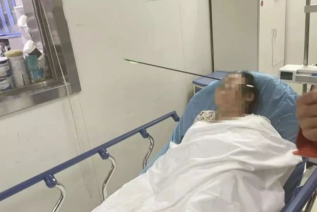 惊险!西安男子小区玩弓箭 80厘米长箭射中女子脸部
