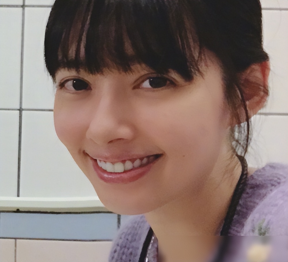 整容|年纪轻轻就眼歪嘴斜的5位明星，有的是天生遗传，有的是整容过度