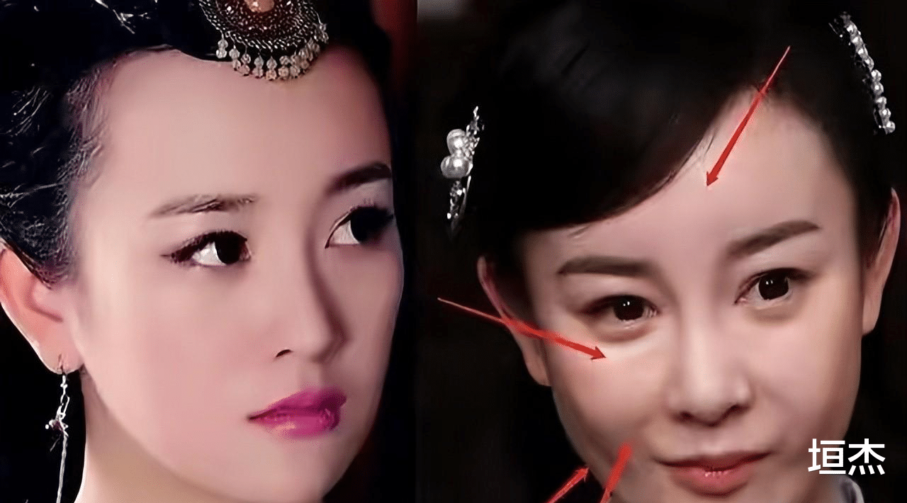 整容|脸没恢复就别演戏了，“馒头脸蛋”演啥都拉胯，这些女星羞不羞