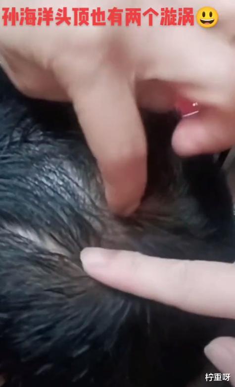 |孙卓回到深圳后，孙妈妈晒孙海洋头上漩涡，头顶发量稀疏惹心疼