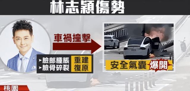 林志颖|这就是脸部3D重建?网友:看着都肉疼,林志颖得忍受多大的痛苦啊!