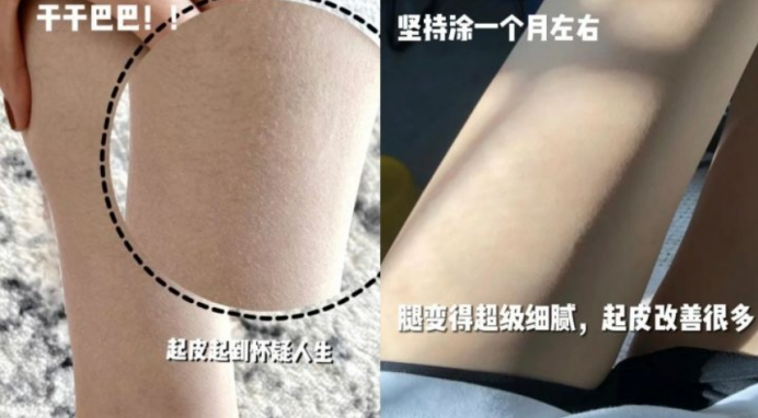 孕期肚子突然爆发3信号,孕妈需警惕!掌握2个妙招,拥有小白肚