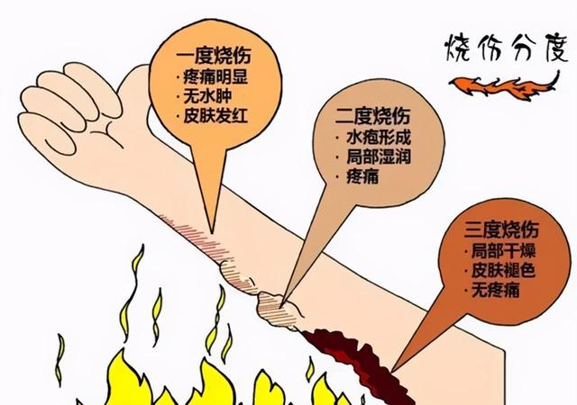 “藏”在你身边的高温物体20000℃,戳破它也无感觉?