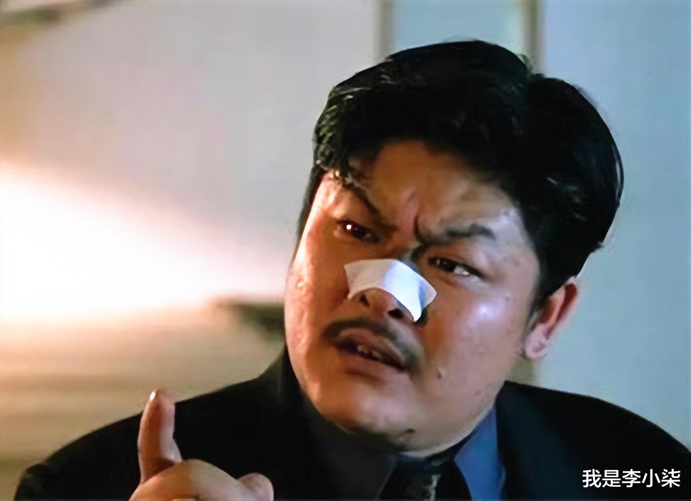 |58岁林雪罕见露面!脸上出现大片黑斑, 不少观众纷纷忧心他的健康