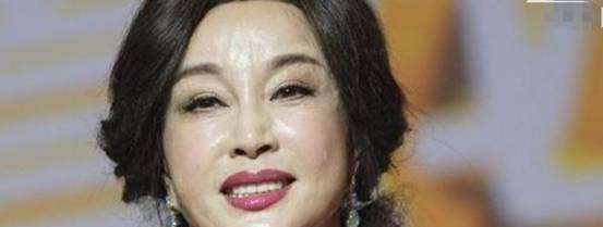 整容 “整容美人”和“自然美人”，老后区别大？对比完你就懂怎么选了