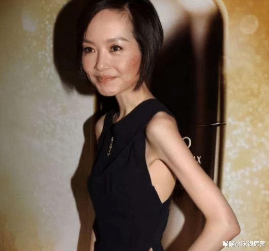 连衣裙 “内卷”下7位暴瘦的女明星,有的瘦到54斤,有的体力不支坐轮椅