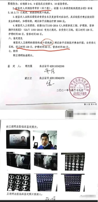 因举报核酸检测造假,王德明遭8人殴打致残,7000万赔偿真相不简单!