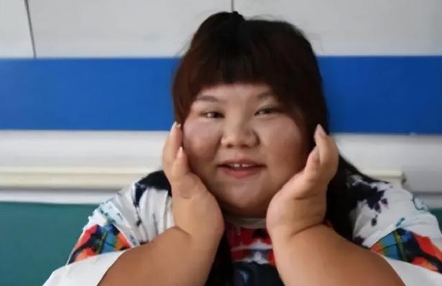 女孩 女孩陈皖枝被老公喂胖至三百多斤的故事