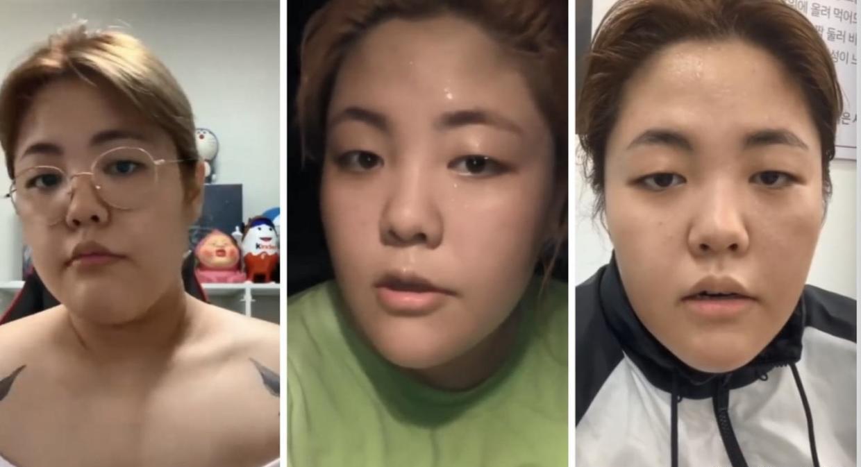 熊黛林|韩国吃播网红狂瘦100斤!花3年变身“金刚芭比”,前后对比惊呆网友