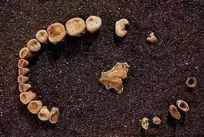 牙科|那些不为人知的种植牙历史廊坊人了解吗？