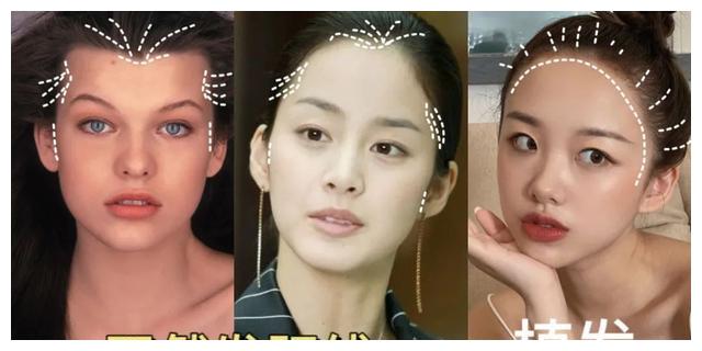 发际线|朴敏英新剧《月水金火木土》,这个发际线好像戴了个假头套?