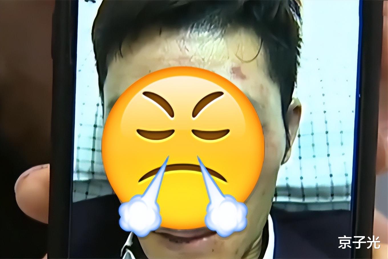 江苏一男子与老乡聚会宴饮,因争吃鱼头被打伤:坐主位的才能吃