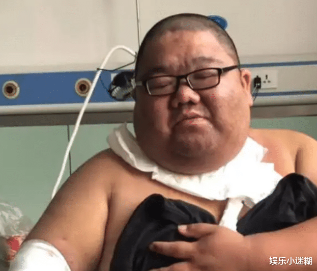 吃播“四巨头”两年去世俩，胖猴仔惜命减200斤，恩克端盆不停吃