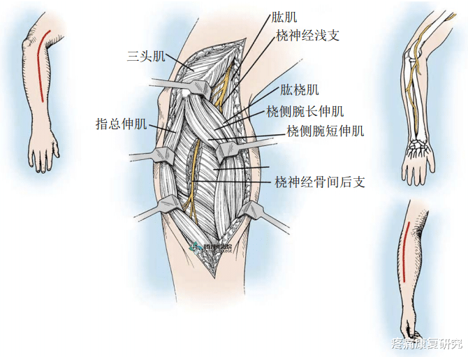 运动|前臂疼痛，这五个动作就能缓解