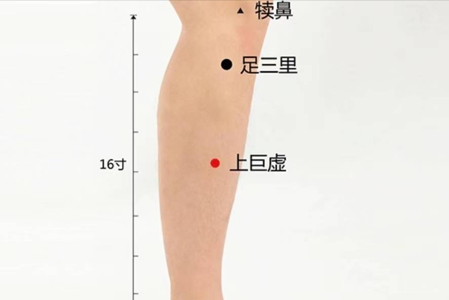 胃癌|经络穴位,一日一学——上巨虚,艾灸可治寒湿泄泻