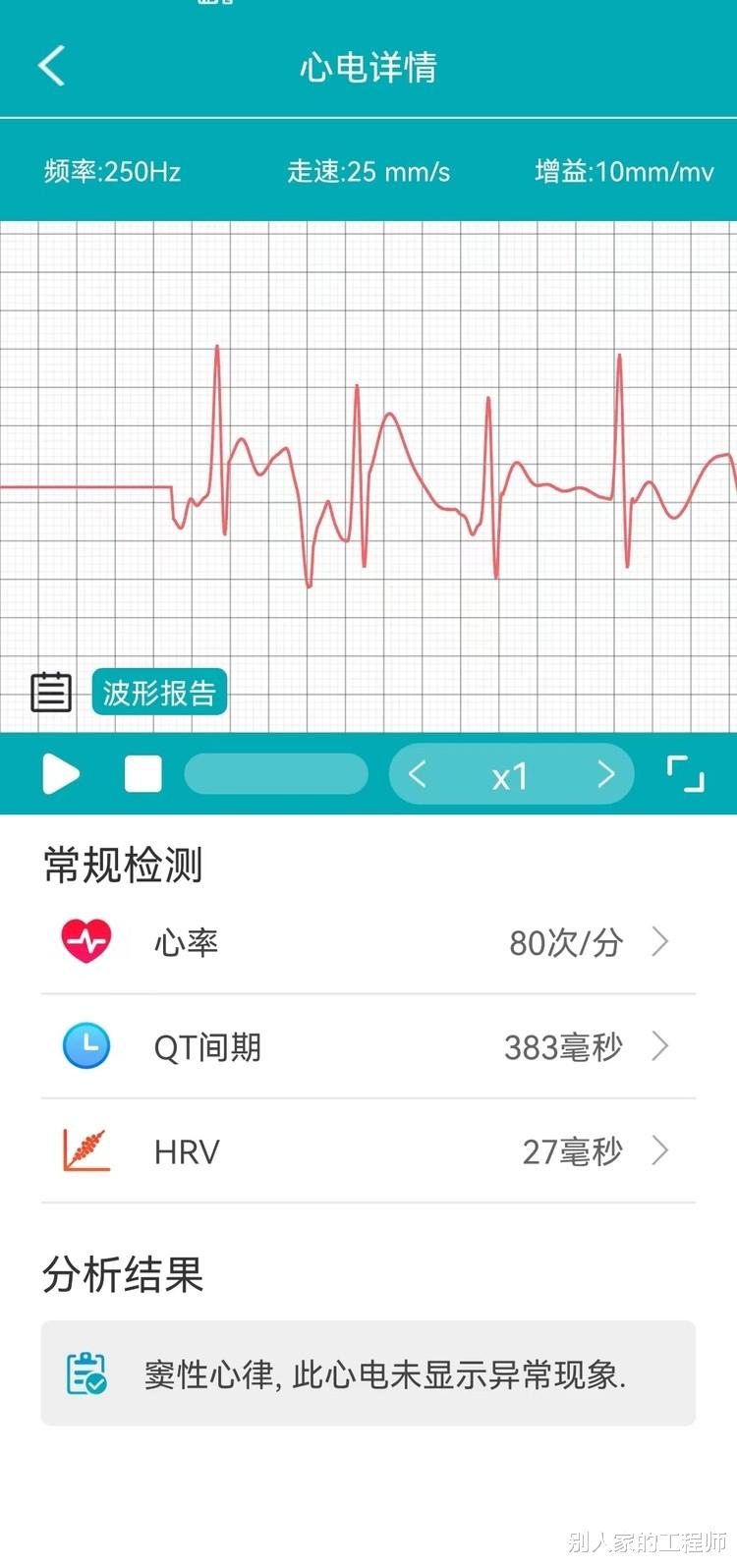 亚马逊|didoY1S高精度血压心电智能手环体验:全面健康管理专家