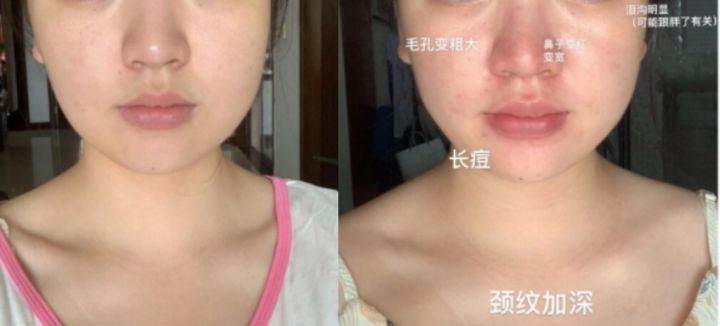 怀孕 怀孕护肤变美有门道!孕期护肤3大误区,新手妈妈千万别掉“坑”