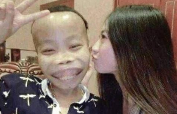 陈山|网红陈山宣布复出，24岁靠卖丑赚5亿身价，被封杀后扬言找女朋友