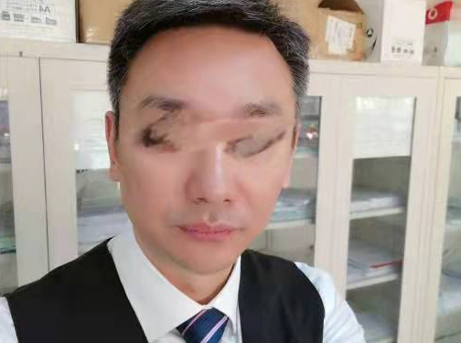 失眠|51岁男子肝癌离世,医生怒喝:1种“水”天天喝,难怪肝“报废”