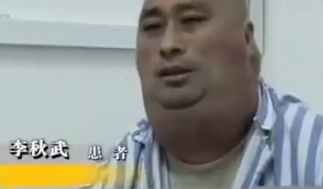 东北男子嗜酒如命,20年喝下30000斤酒引发怪病,医生:治不了