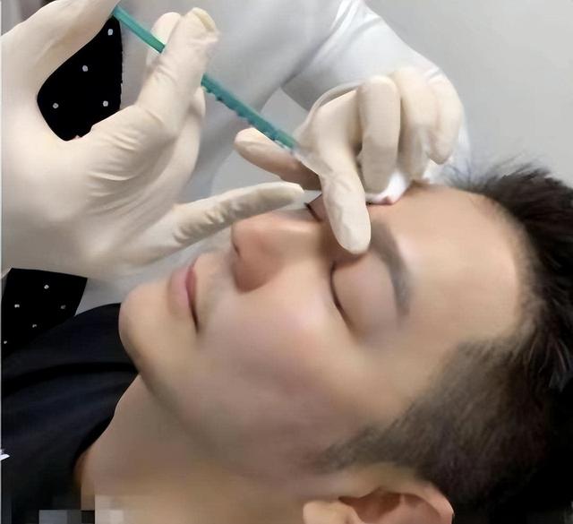医美|陈浩民坦白整容，称定期做医美，果然实力男明星也过不了颜值关