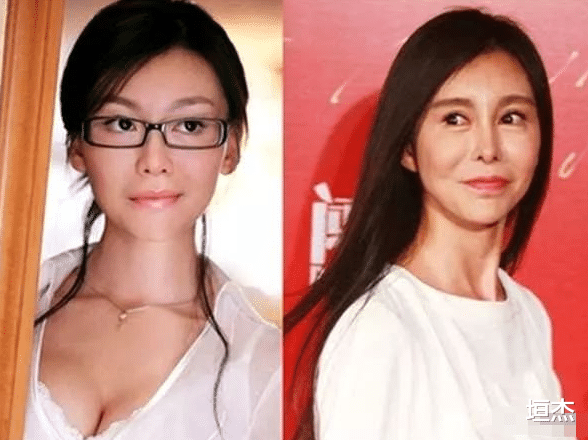 刘晓庆|刘晓庆拉皮多次耳粘脸，郎朗前女友变成锥子精，整容后遗症太可怕