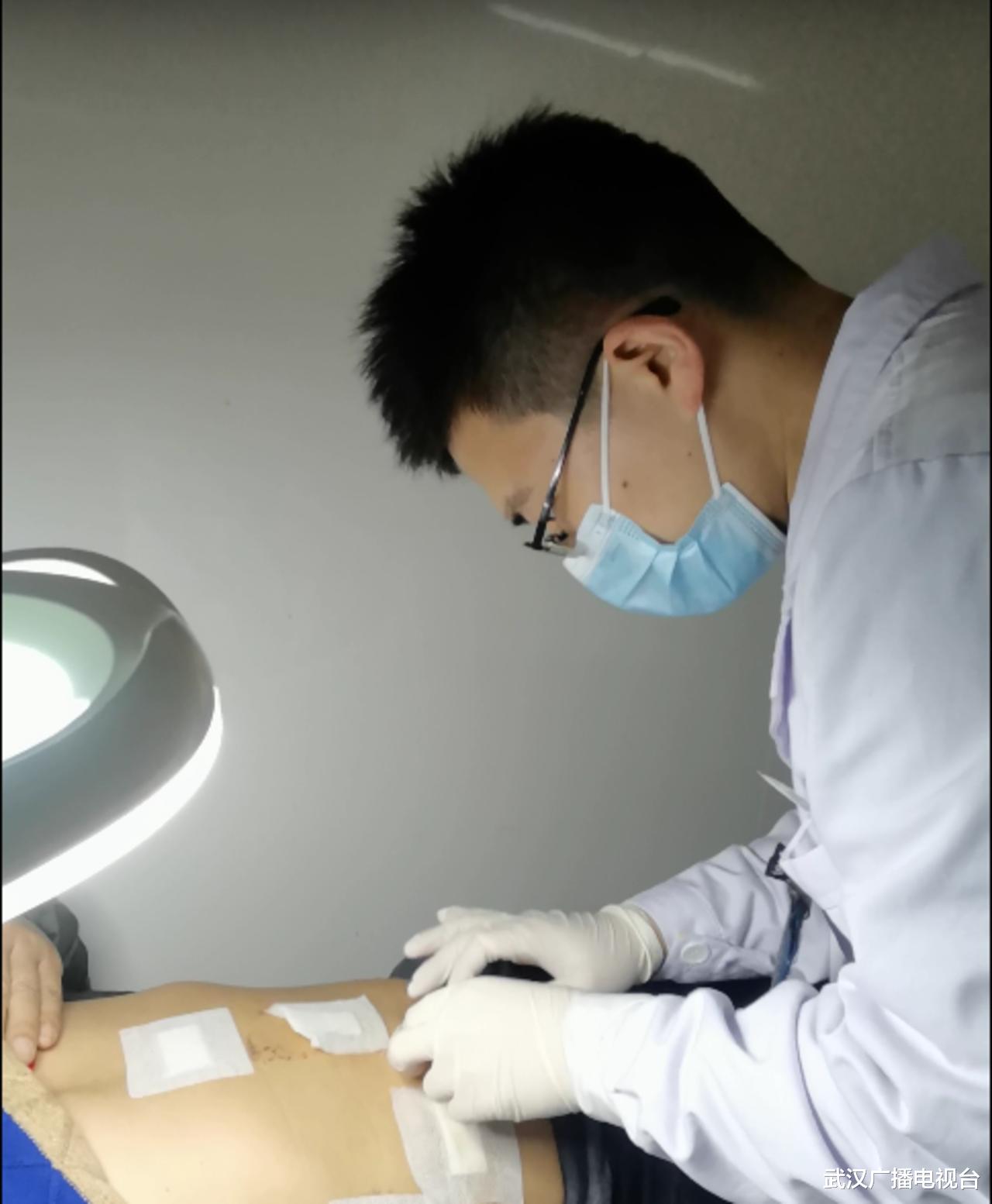 香港|老钓友腹胀不适两个月，专家提醒：钓鱼要远离寄生虫疫区水域