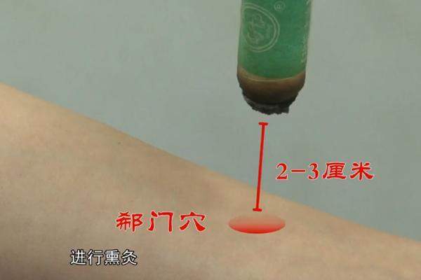 医生|经络穴位，一日一学——郄门，心绞痛的应急穴