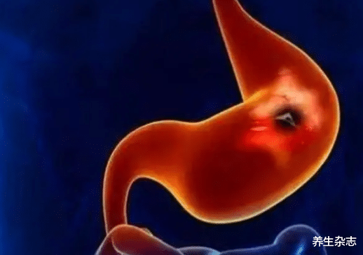 胃病|40岁大姐养胃半年,胃炎转癌离世,医生:胃病吃“它”,雪上加霜