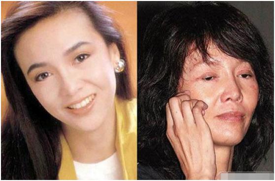 整容|7位被整容毁了的明星,有人美丽尽失事业滑坡,有人甚至赔了性命