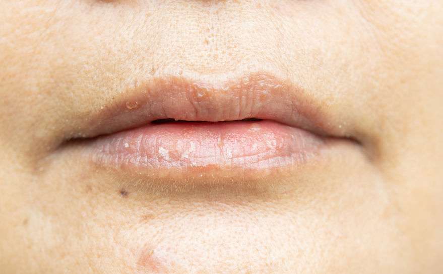 社区卫生服务中心|嘴唇经常发紫,或与这5个问题有关,发现后,要及时检查