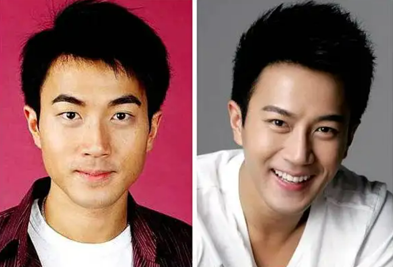 汤唯|8位“改头换命”的男明星，王一博脸已僵硬，刘恺威眼皮才是灵魂